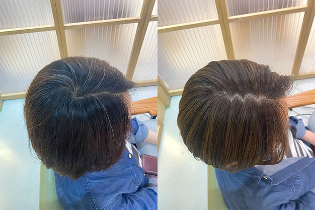 Before ＆ After
